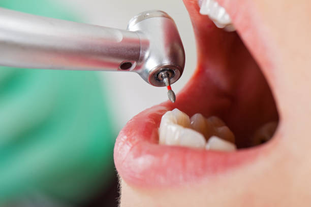 Best Weekend Emergency Dentist in Point Roberts, WA